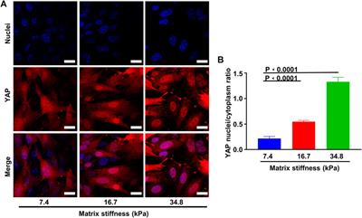 Matrix Stiffness Induces Pericyte-Fibroblast Transition Through YAP Activation